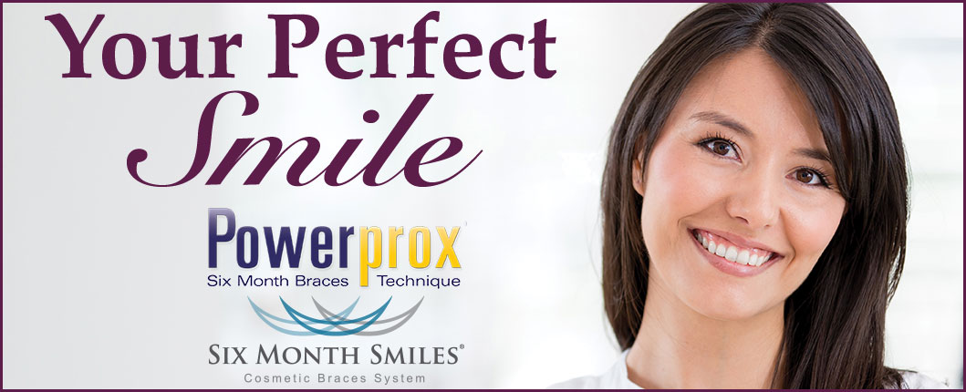 Scripps Ranch Powerprox Six Month Braces