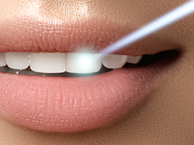 Melinda Marino, DDS Family and Cosmetic Dentistry | Crowns  amp  Caps, Cosmetic Dentistry and Pediatric Dentistry